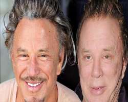 Mickey Rourke before surgery